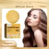 Hair Shampoo Soap Promote Hair Growth Thicker Anti Dandruff Nourishing Scalp Shampoo Bar Frizz Repair Hair Thinning Treatment 1