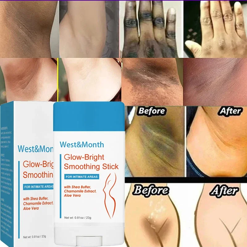 S4f061383d1d047cdbc0cb204a267fa9bN Body Whitening Stick Lighten Armpit Private Parts Melanin Dark Spots Knee Butt Nipple Bleaching Cream Brighten Skin Care Product
