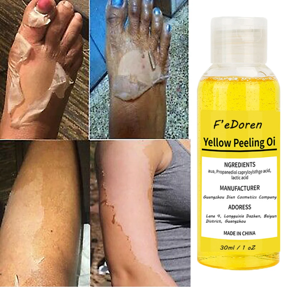 yellow peeling oil