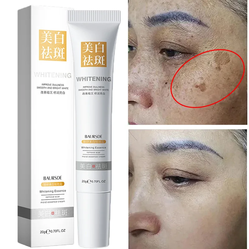 

Whitening Freckles Cream Effectively Removes Dark Spots Chloasma Anti-Pigmentation Improve Dullness Fast Brighten Skin Care