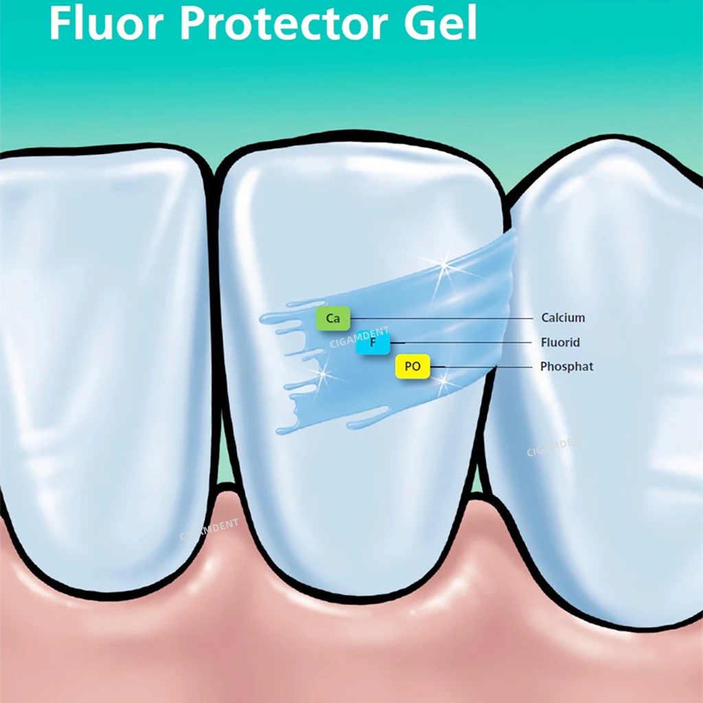 AG Fluor Protector Dental Fluoride Varnish Gel 0.4ml Teeth Sensitive Desensitizing Protective Oral Care