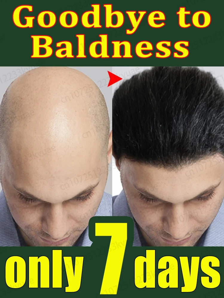 Hair Growth Serum Rosemary Repair Baldness and Hair Loss Seborrheic Alopecia Hereditary Loss Middle-aged