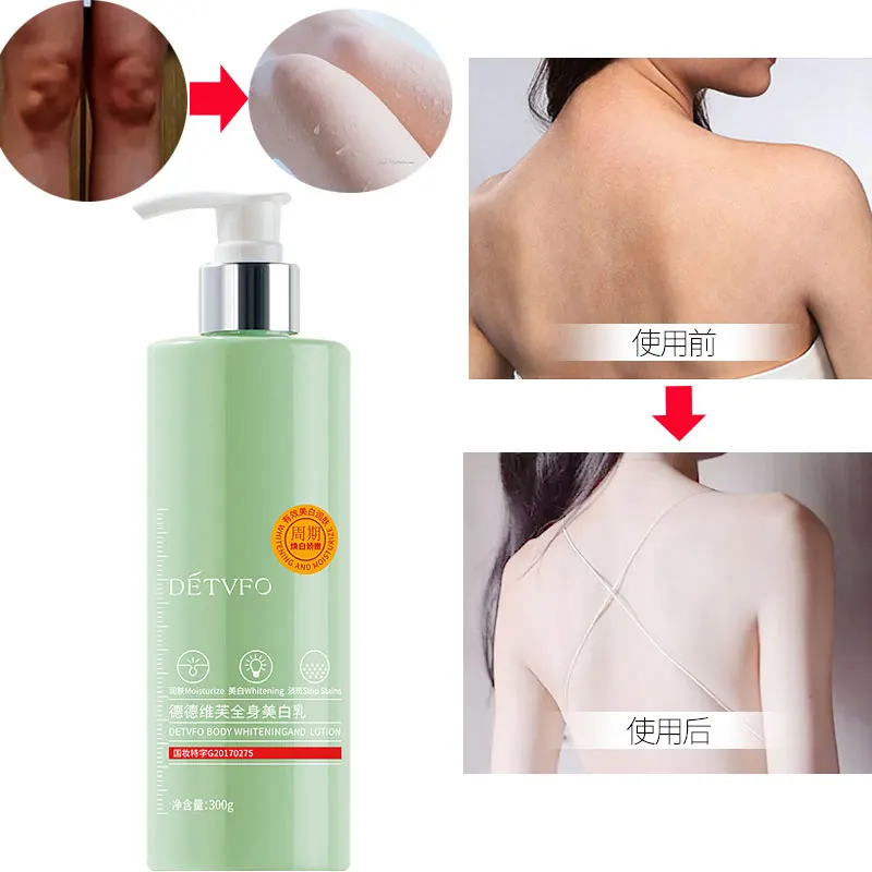 

Body Whitening Cream Moisturizing Refreshing Without Greatness Whole Body Milk Skin Lightening Cream for Dark Skin Skin Care