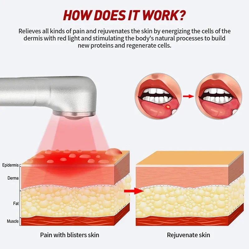 Red Light Therapy Wand Cold Sore Device Red Light Therapy 660nm 850nm Near Infrared LED Light Therapy Machine for Mouth Sores