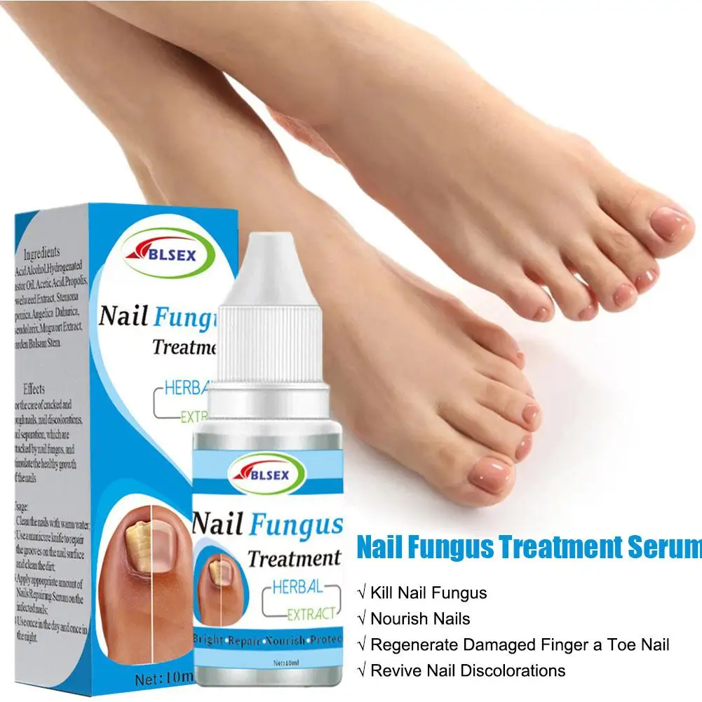 

10ml Fungus Nails Treatment For Fingernails Toenails Repair Onychomycosis Paronychia Anti Infection Nail Fungal Removal Liq M2F1