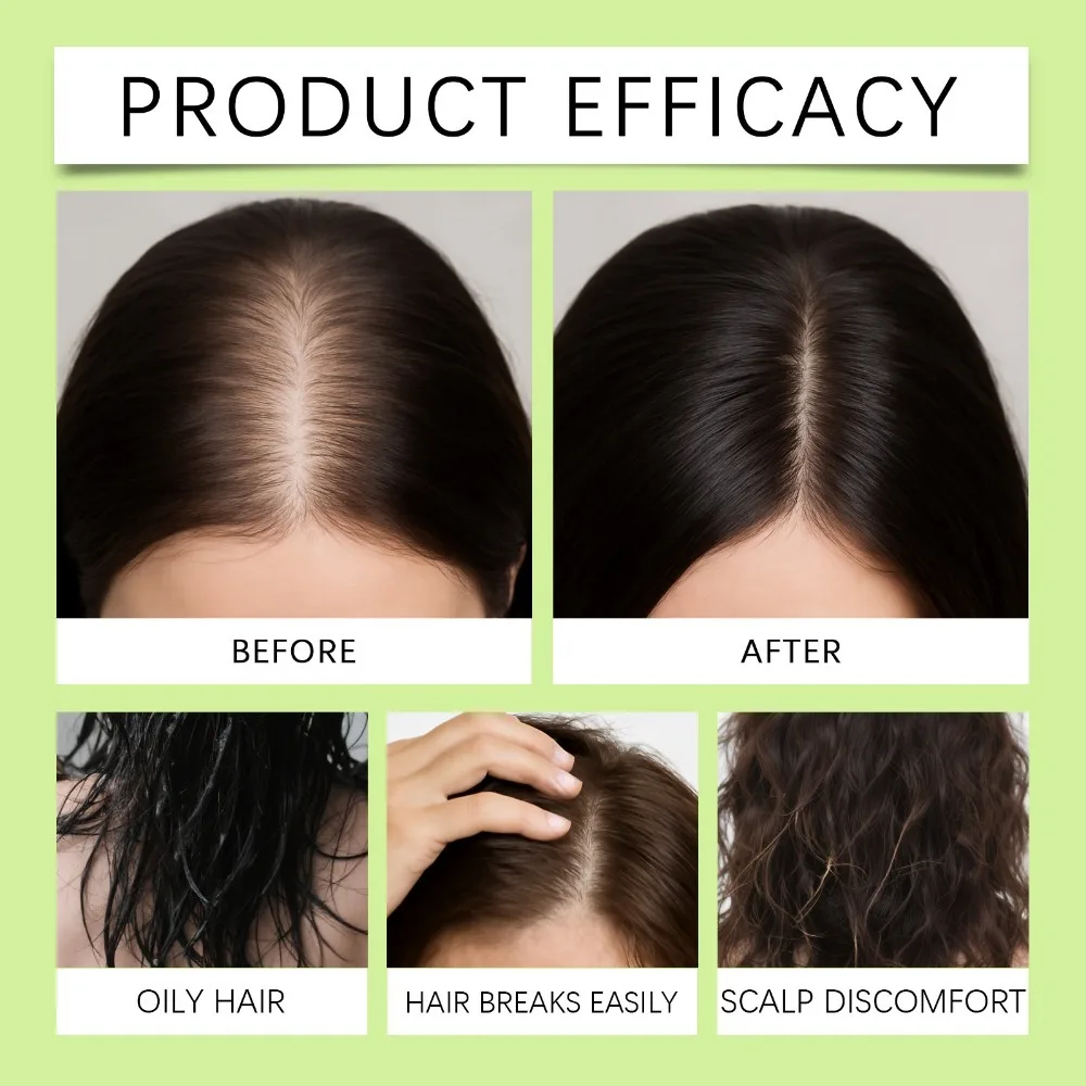 Hair Serum Gentle Nourishes the Scalp and Cares for the Softening Hair Care Daily Care Scalp Serum - 4