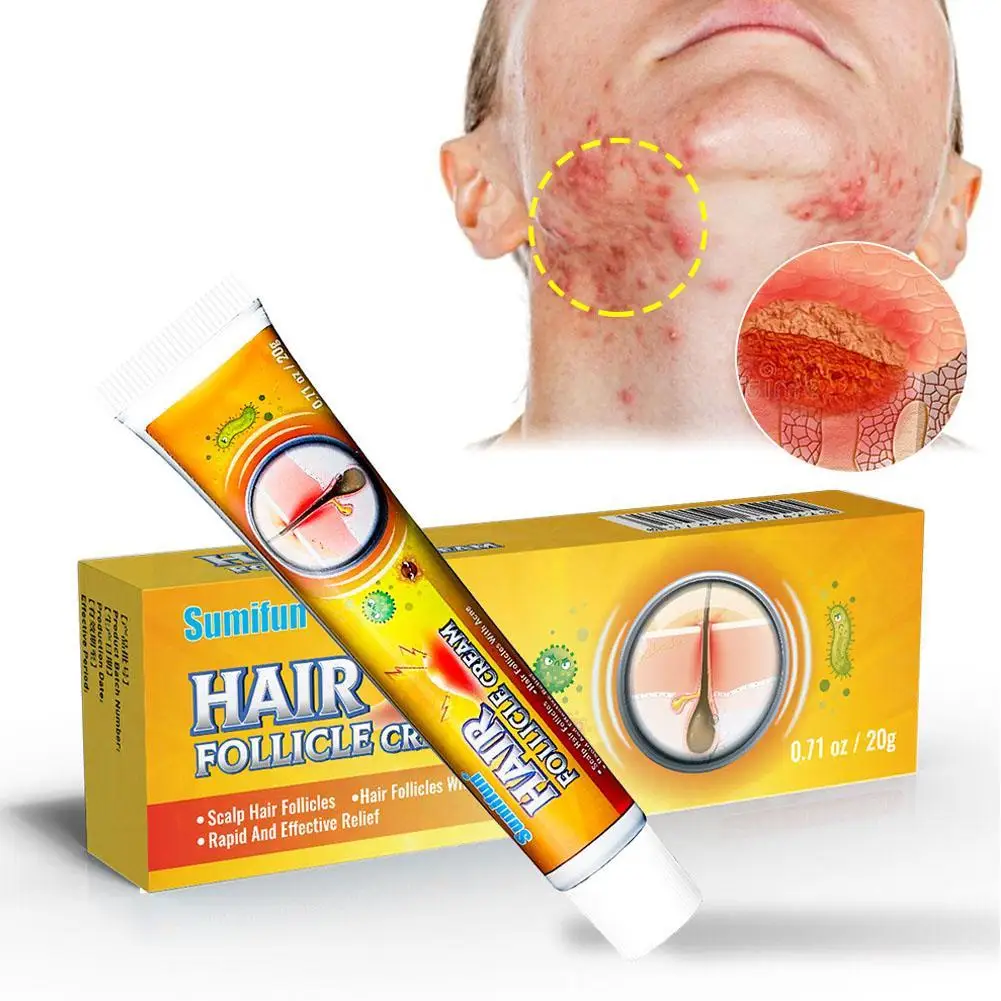 

Sumifun Folliculitis Cream Scalp Hair Folliculitis Treatment Ointment Cysts Papules Spot Remover Pustules Skin Ulcers Medicine