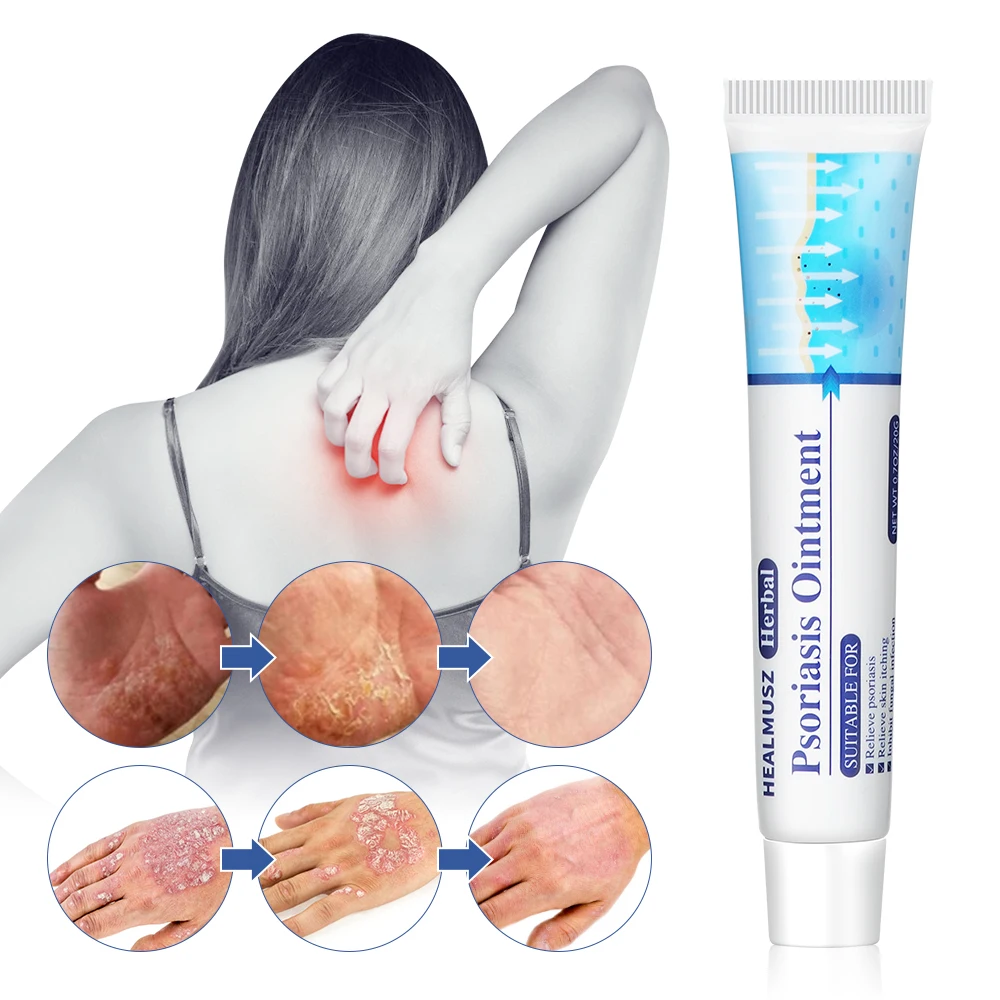 

20g Herbal Antibacterial Cream Psoriasis Cream Anti-itch Relief Eczema Skin Care Rash Urticaria Desquamation Treatment Cream