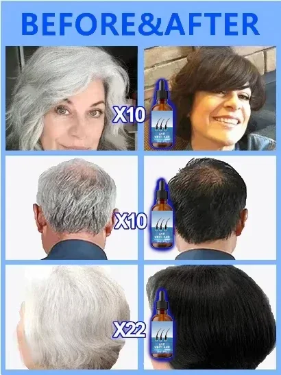 restauration de la couleur naturelle des cheveux et restauration de la sant&eacute; des cheveux blancs au noir