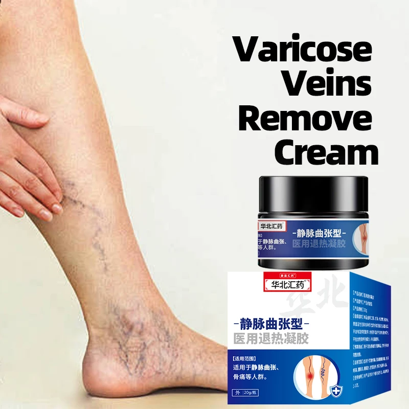 20g Varicose Veins Remover Cream Phlebitis Pain Relief Health Care Varicosity Angiitis Spider Treatments Herbal Medical Plaster