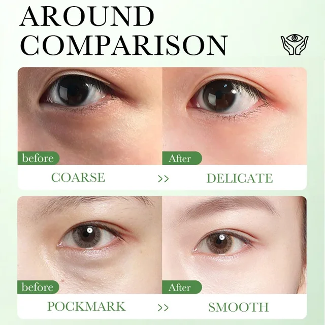 Centella Asiatica Eye Cream Moisturizes Tightens Lightens Dark Circles Eye Cosmetics Smooth Eye Lines Nourishes  Makeup 4