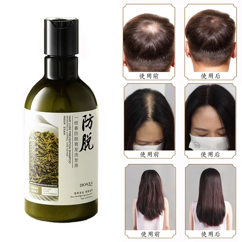 250ml Hair Loss Hair Growth Serum Shampoo Hair Care Product Ginger Anti  Effective Loss Treatment