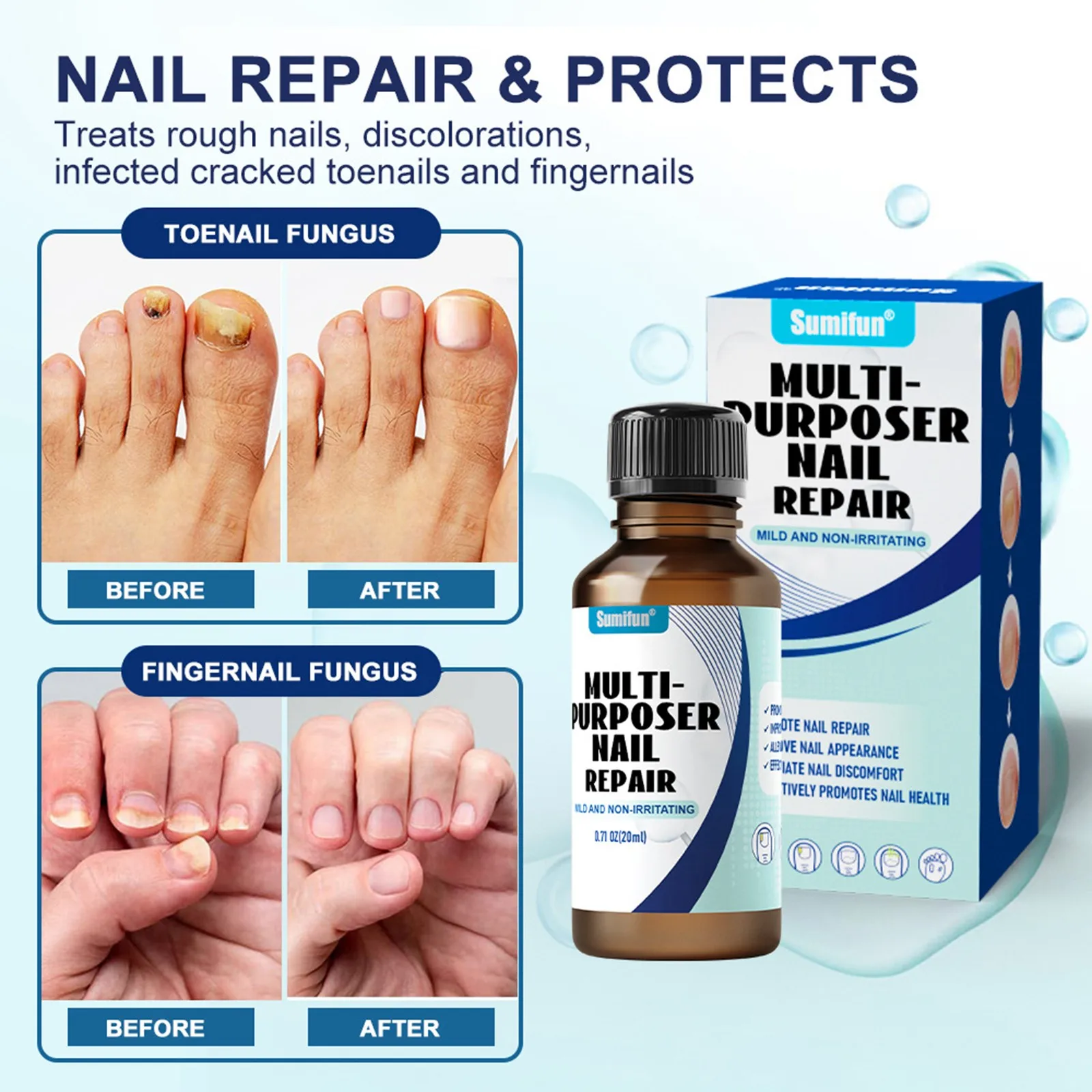 Nail Polish Solution 20ml