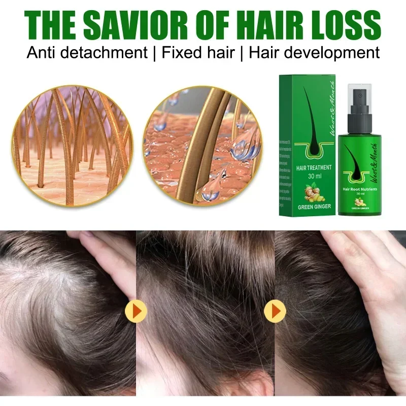 Herbal Hair Growth Products Men women Anti-alopecia Spray Care Scalp Treatment Prevent Hair Loss Essential Oil hair growth oil hair restoration products