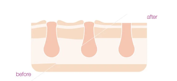 S4f8f84445da9465c95b2350199364ab7o