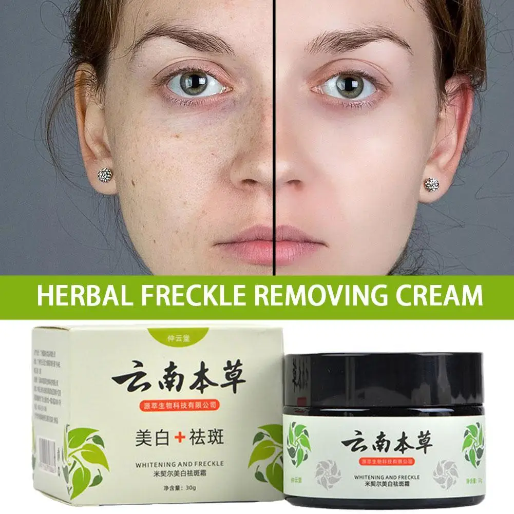 

Yunnan Herbal Whitening Freckle Removal Cream Spot Fading Fade Spots Repair Moisturizing Brightening Beauty Skin Care Products