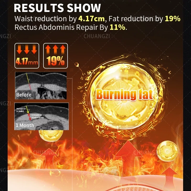 Рисунок 6 - EMSzeropro Body Sculpting Pro Электростимуляция