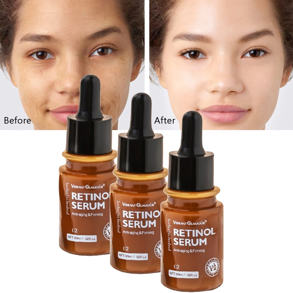 Retinol Face Serum Anti Aging Serum Dark Spot Corrector 30ML For Lines Wrinkles Boost Collagen Aid Acne Treatment face serum
