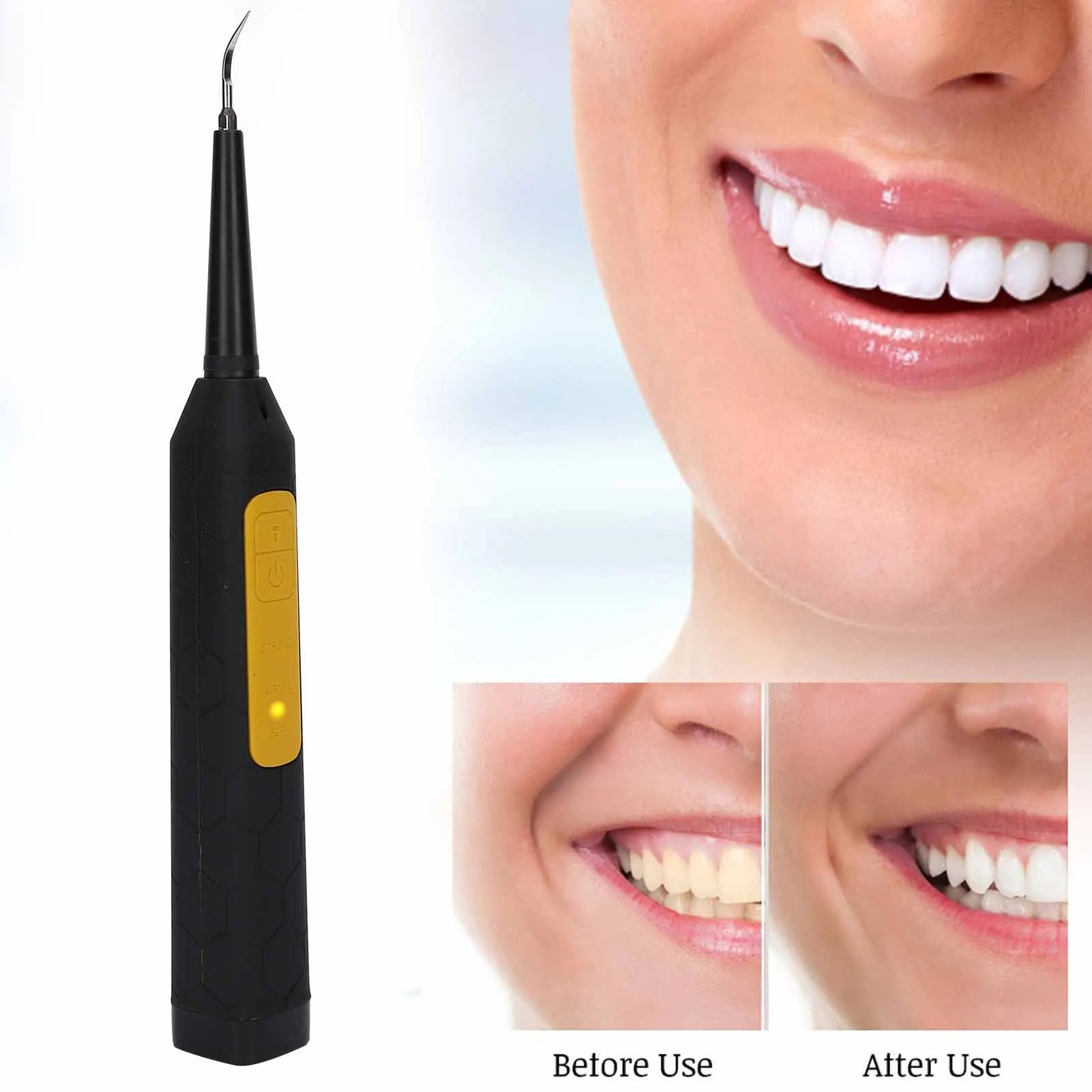 HighQuality Stainless Steel Head Tooth Cleaner Electric Calculus Remover Portable Teeth Tartar Remover Oral Care Tool USB Charg for 3d printer extruder mk7 mk8 mk10 extrusion gear 40 tooth teeth brass or stainless steel drive gear feeding gear wheel