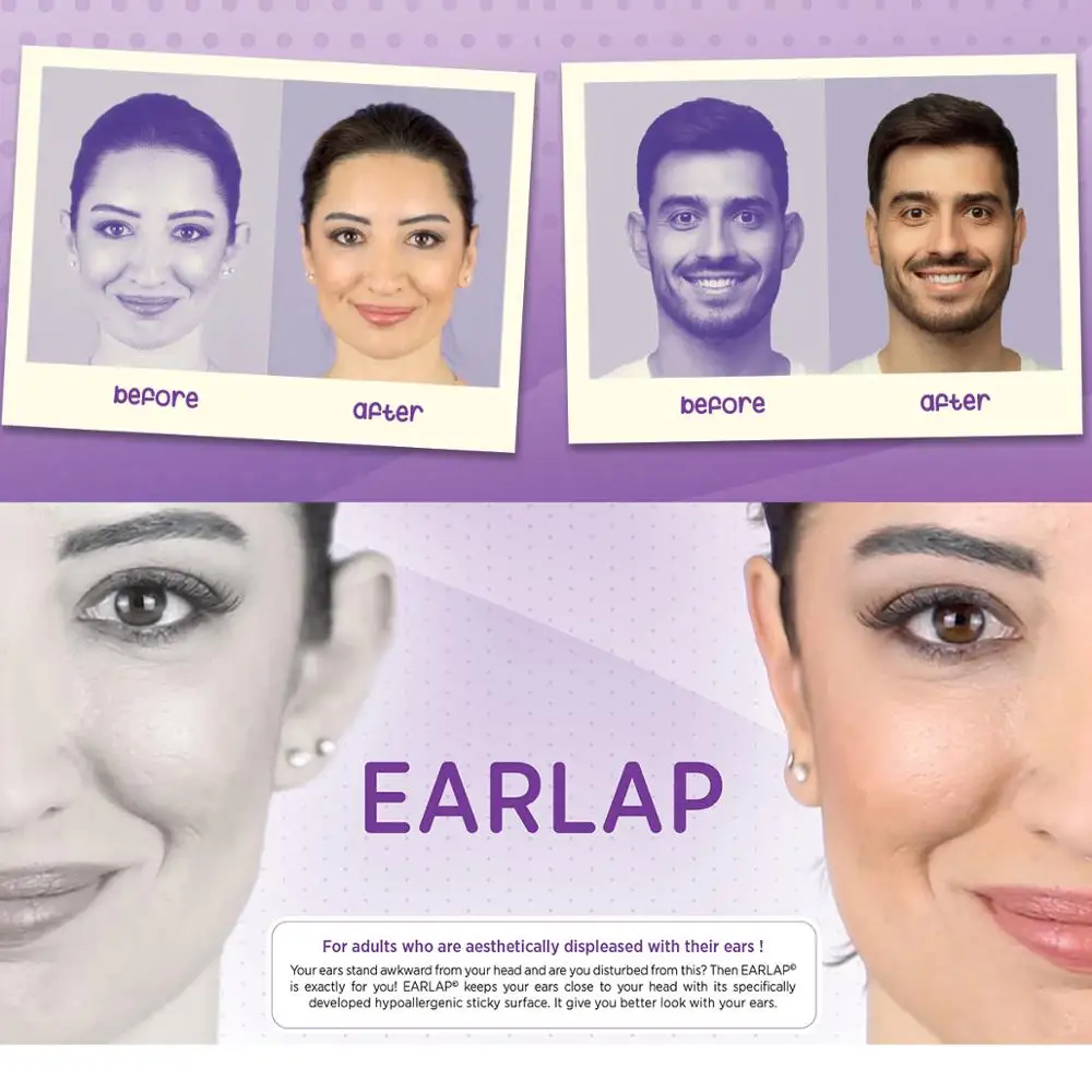 Beauty tapes EARLAP ear concealer corrective instant effect bonding system protruding ears, ear gluing tapes