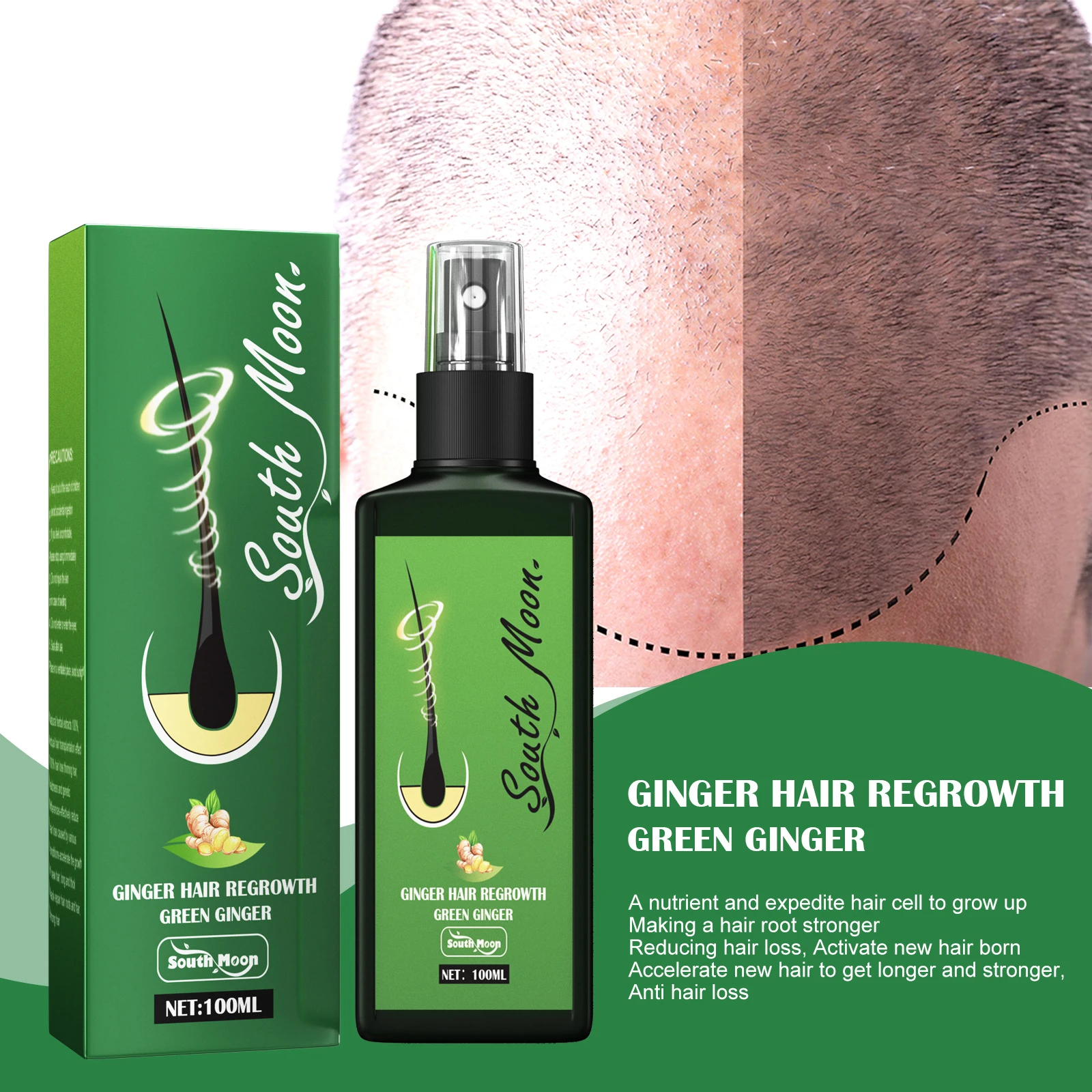 100ml South Moon Original NEO Hair Growth Serum Oil Green Lotion New Pack  Fast Effective Growth Hair Care Spray| | - AliExpress