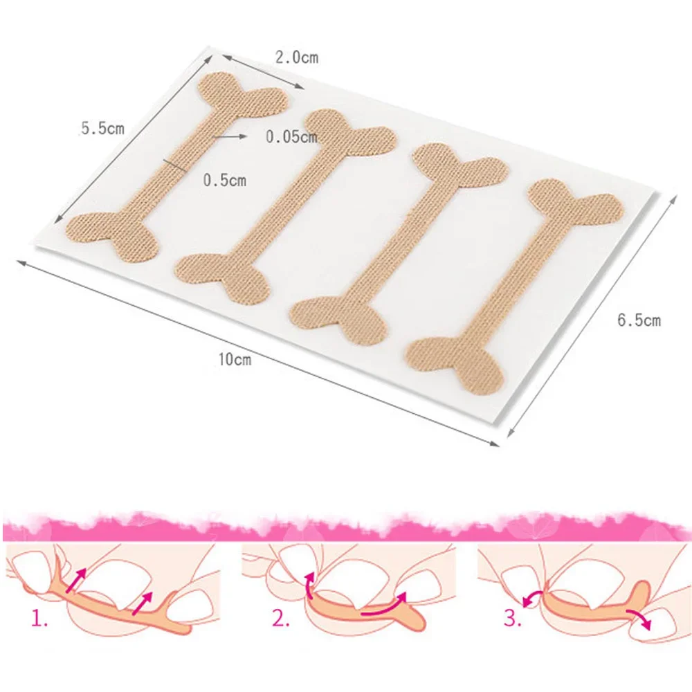 20-100pcs Ingrown Toenail Corrector Stickers Paronychia Treatment Pedicure Toe Nail Care Corrector Patch Correction Stickers