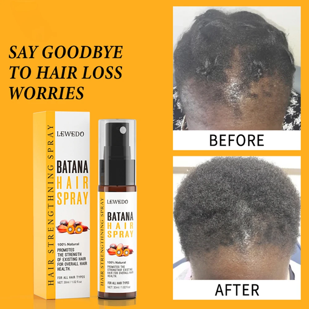 Hair Growth Serum 30ml Batana Anti Hair Loss Spray 50ml Batana Hair Growth Essence Oil