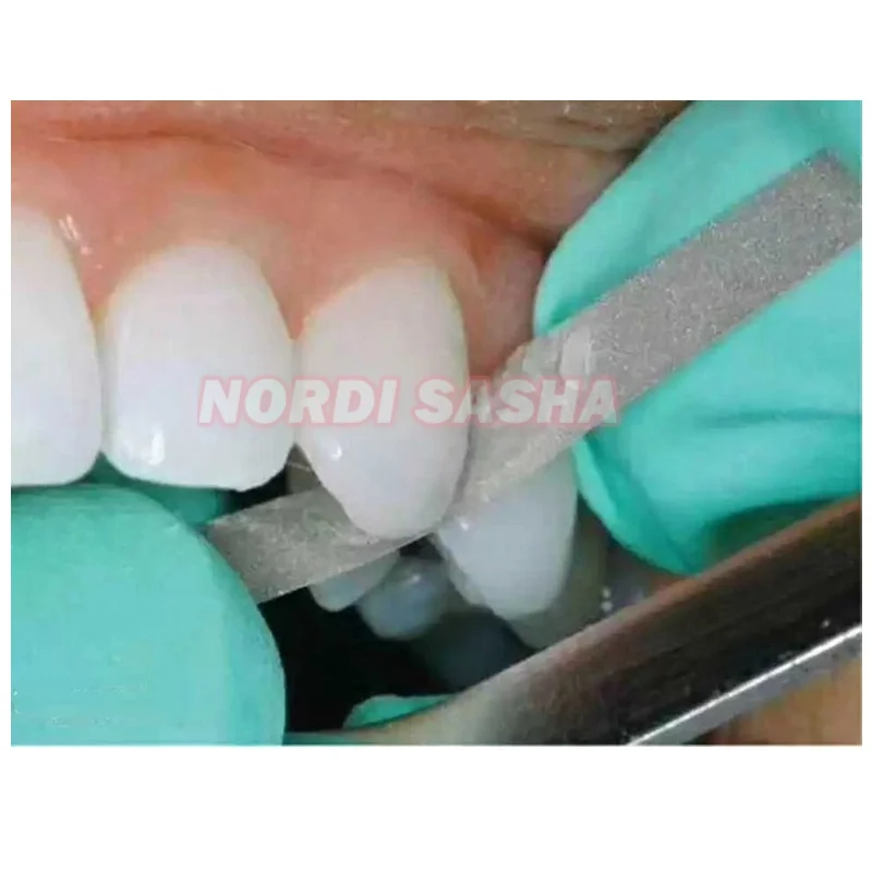 Dental Microdont Stainless Steel Abrasive Strips For Finishing - Foto 4