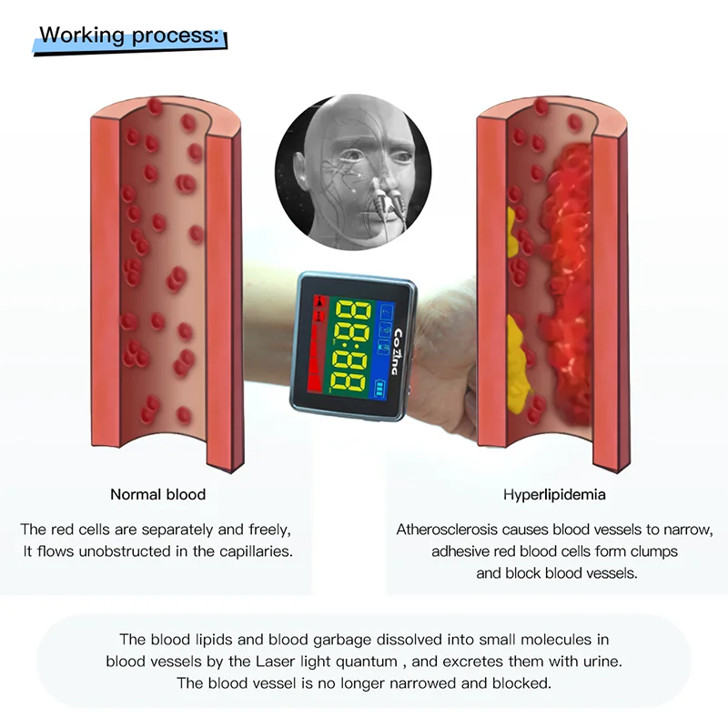 

Wearable laser device laser watch for hypertension and other symptoms