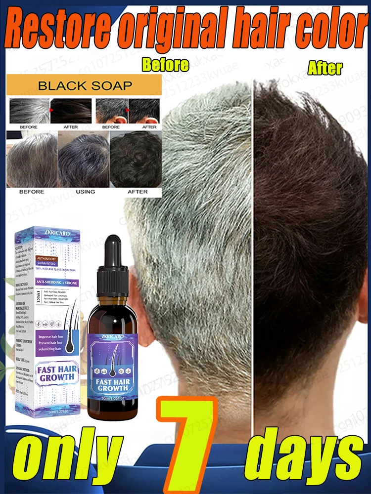 Hair color restorer turn white hair into black hair remove gray hair in 7 days restore natural healthy hair color