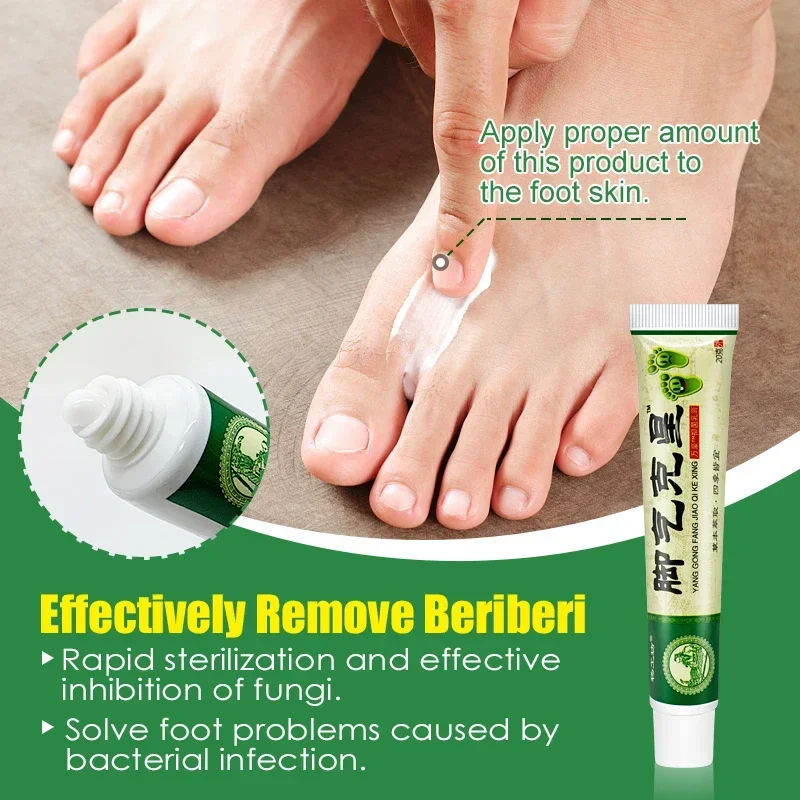 Anti Fungal Cream Herbal Cream 1pcs Foot Tinea Pedis Treatment Cream Treat Beriberi Ointment Anti-itch Inhibits Fungus Peeling Athlete Foot Medical Cream A942