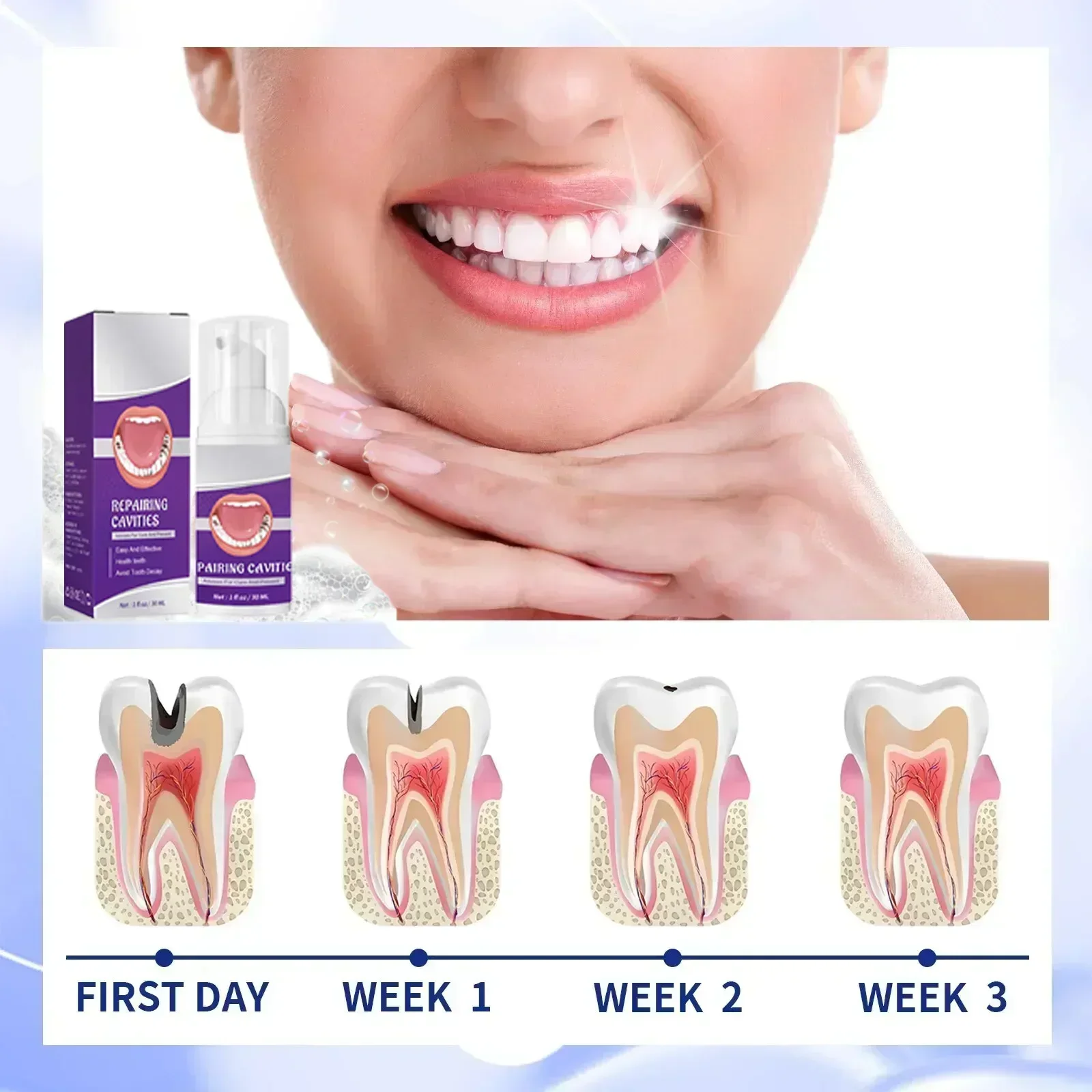 Toothpaste for Teeth Whitening Cavities Caries Removal Plaque Stains Decay Repair Dental Calculus