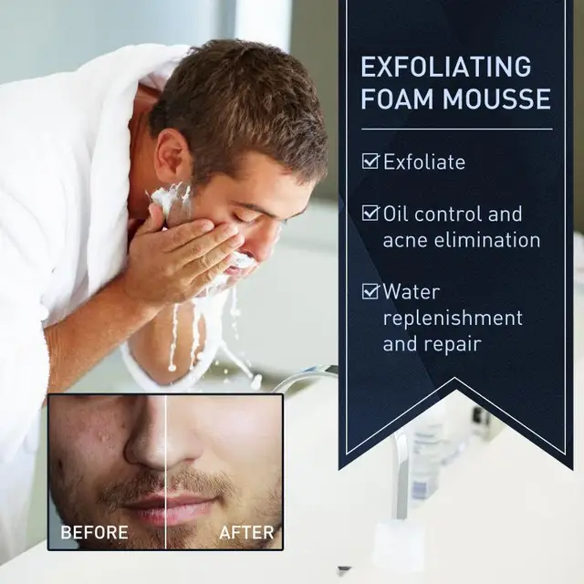 Men facial cleanser mousse foam face washing cleansing pores acne blackhead remove oil control moisturizing skin
