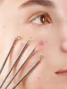 Blackhead Acne Remover 4pcs Comedone Black Head Blemish Pimple Removal Needle Face Skin Beauty Care Cleansing Pore Cleanser 1