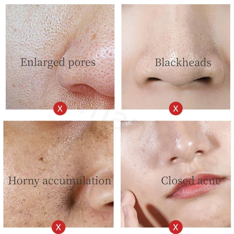 Рисунок 3 - Увлажняющее и Отбеливающее средство