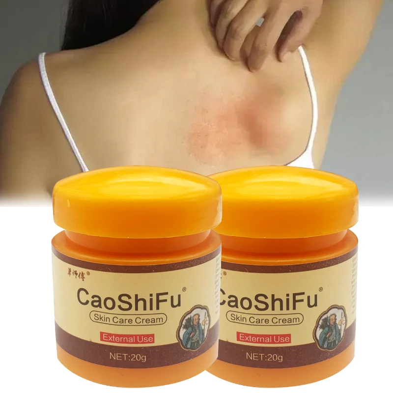 20g Psoriasis Antibacterial Cream Dermatitis Eczematoid Ointment Anti-Itch Chinese Herb Skin Care Cream Psoriasis Ointment