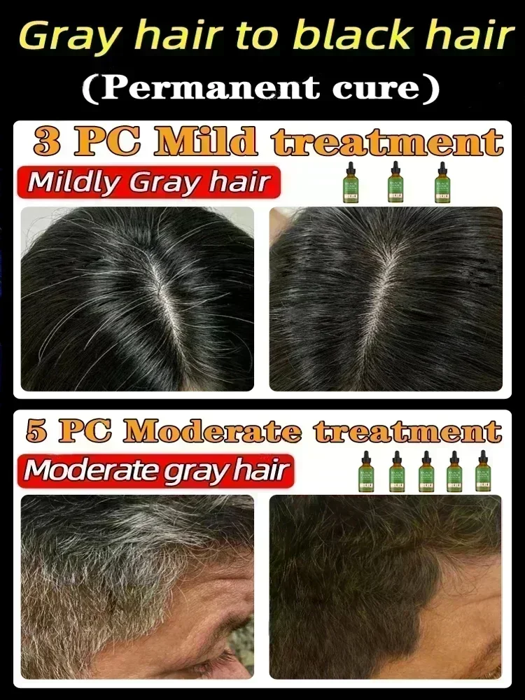 Restore Your Natural Black Hair-Guaranteed Results