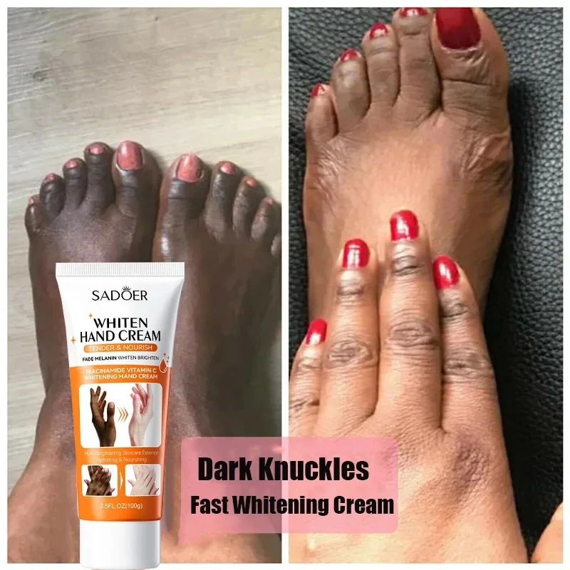 New Dark Knuckles Whitening Hand Cream Pigmentation Correctors for Black Skin Anti-Drying Removal Dead Cracked Repair Products anti wrinkle anti aging rejuvenation whitening firming wrinkle removal crow s feet lines black eye circles eye bags elasticity