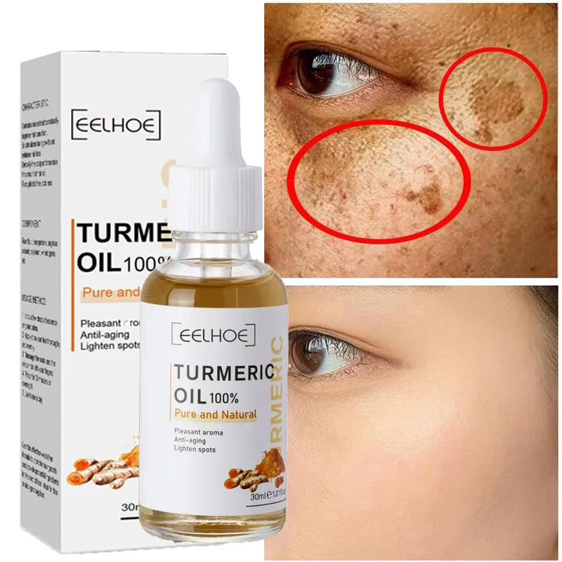 

30ml Turmeric Spot Lightening Essence Remove Dark Spot anti aging Face Serum Whitening Brighten Skin Fade Pigment Skin Care