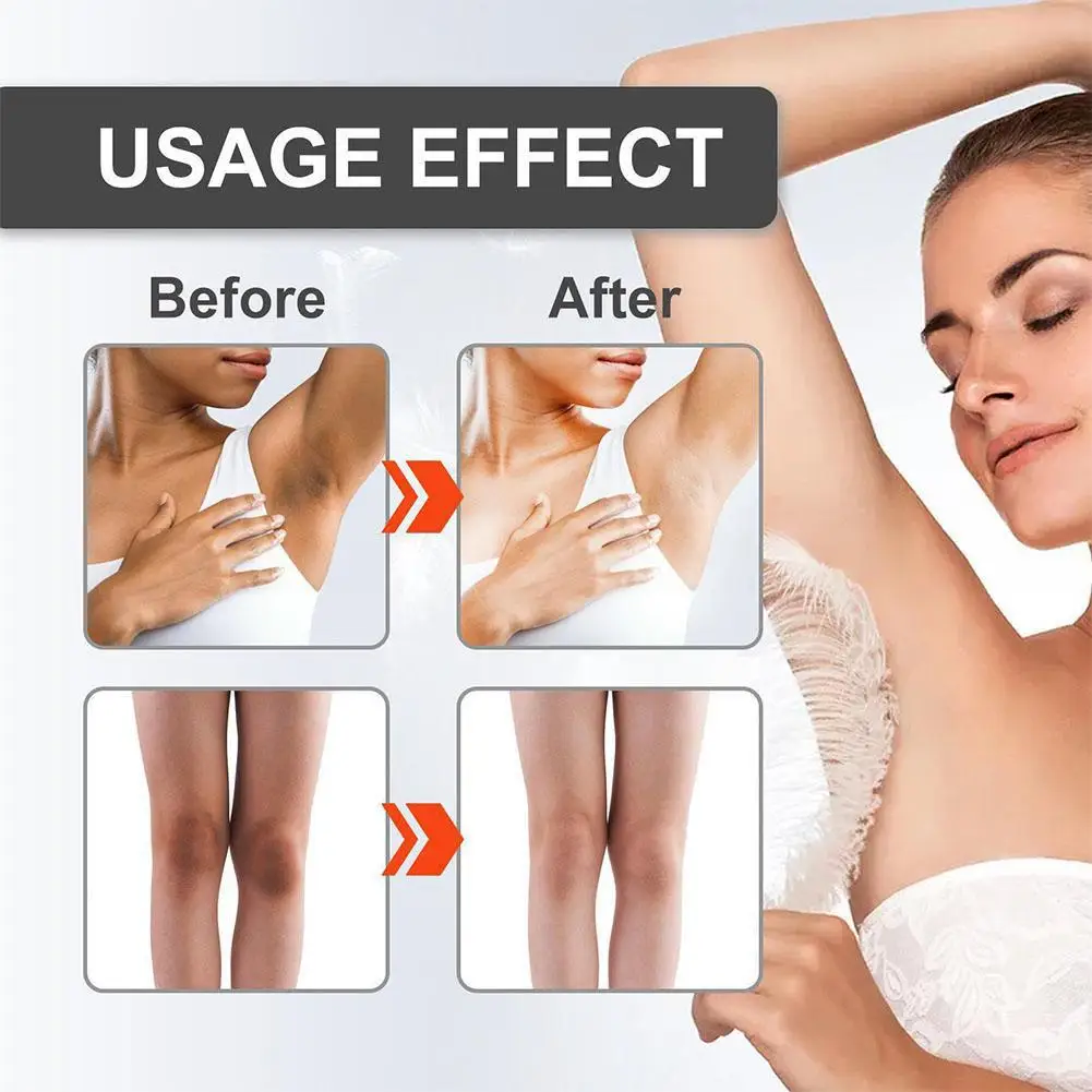 30ml/60ml Body brightening body cream Snow Bleach Cream Nicotinamide Removal Dark Spot Melanin Brighten Private Parts Underarm Bleaching Armpit Knees