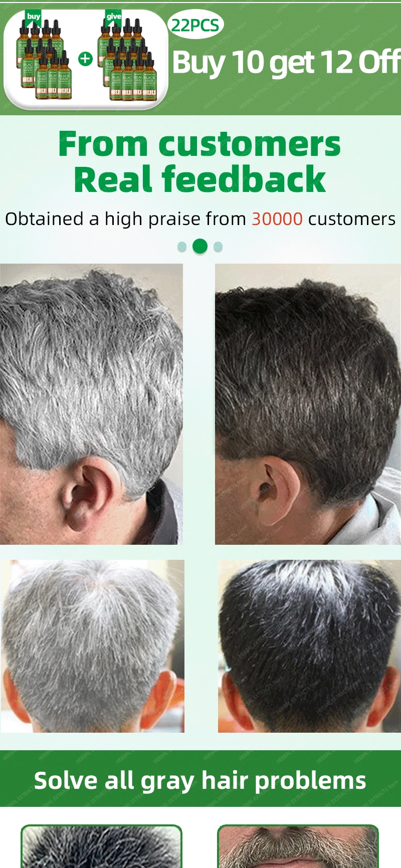 Description Picture 3 of itemAnti-Gray Hair Serum Gray Hair Treatment White Darkening