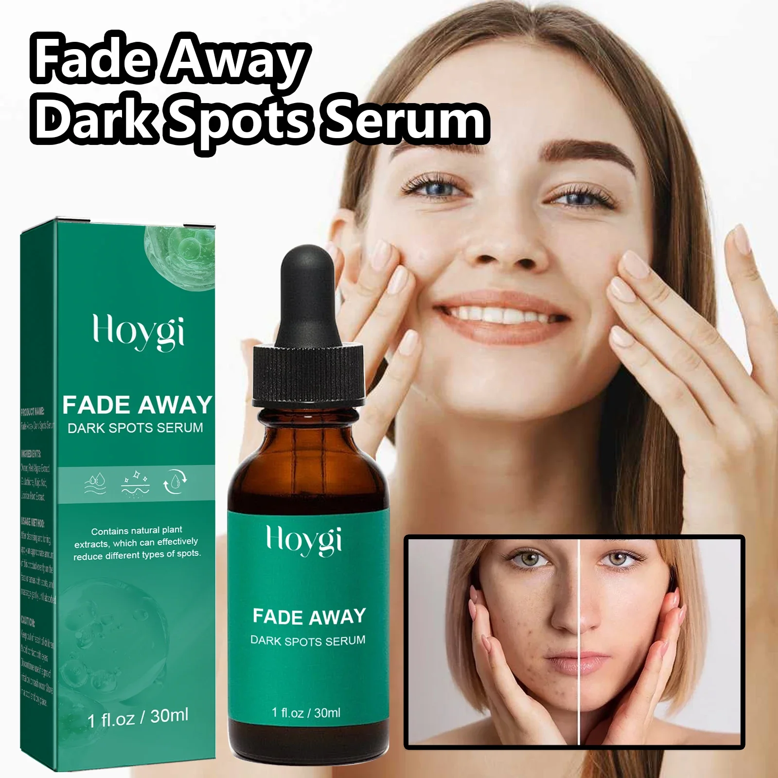 Dark Spot Remover Serum For Face Sun Melasma Freckles Pigment Age Spots Removal Freckle Whitening 6