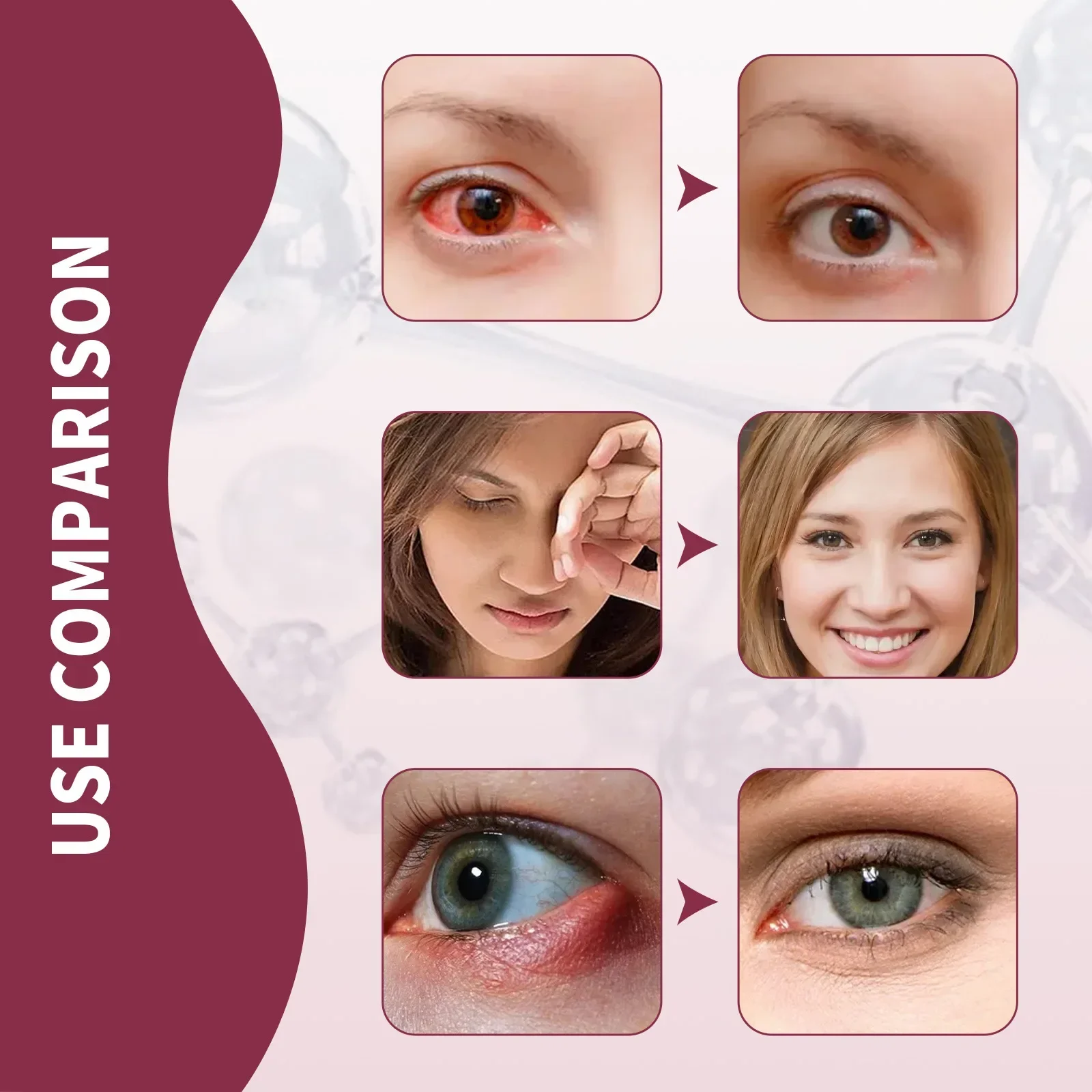 30ml Eye Sweet Soothing Essence Relieving Eyes Sweet Youth Moisturizing Eye Essence Treatment Bags Moisturizing