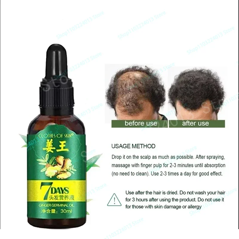 

Ginger Hair Growth Spray Strengthening-Hair Massage Scalp Dense-Hair Strengthening Hair Loss Prevention Repair Nourishing Liquid