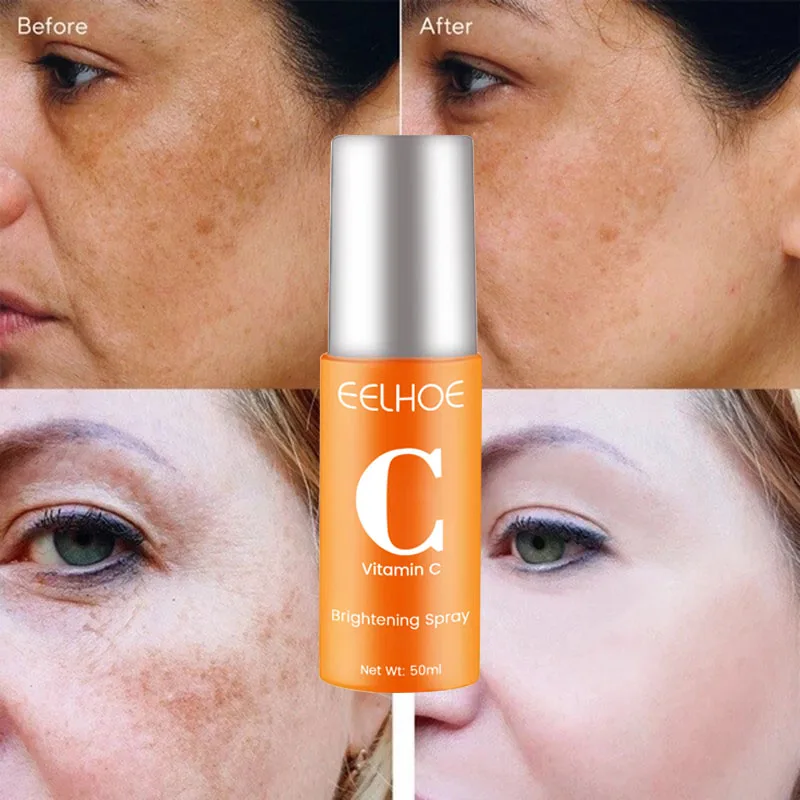 Siero viso sbiancante per lentiggini alla vitamina C Rimuovi le macchie scure Dissolvenza Melasma Anti-età Illumina Tonico idratante all'essenza_voghion.com