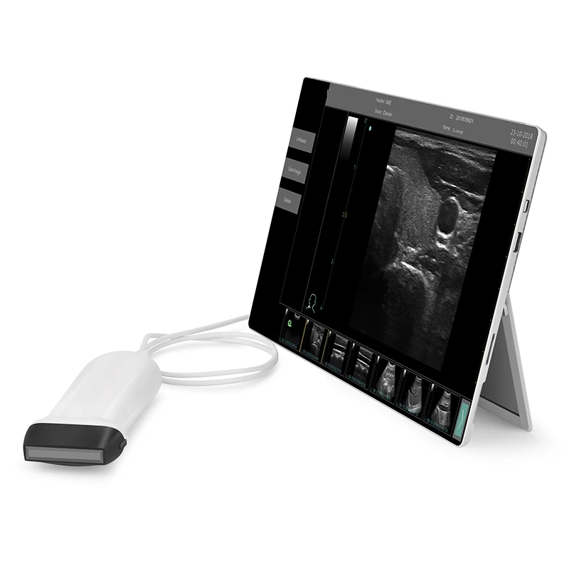 Thyroid Ultrasound Puncture Model 3