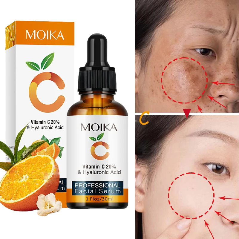 

Vitamin C Whitening Facial Serum Remove Freckle Dark Spot Repair Fade Melanin Improve Dull Anti-Aging Moisturizing Skin Care