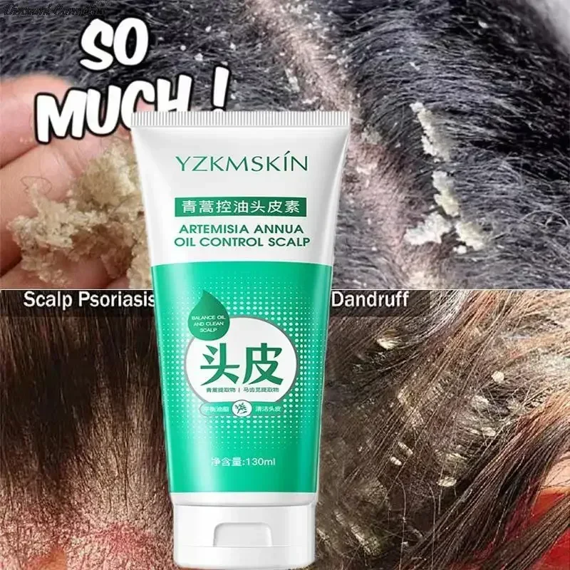 Scalp Cleansing Shampoo Dandruff Seborrheic Follicles Antibacterial Anti itching Mites Oil Control Psoriasis Removal Acne 120ml