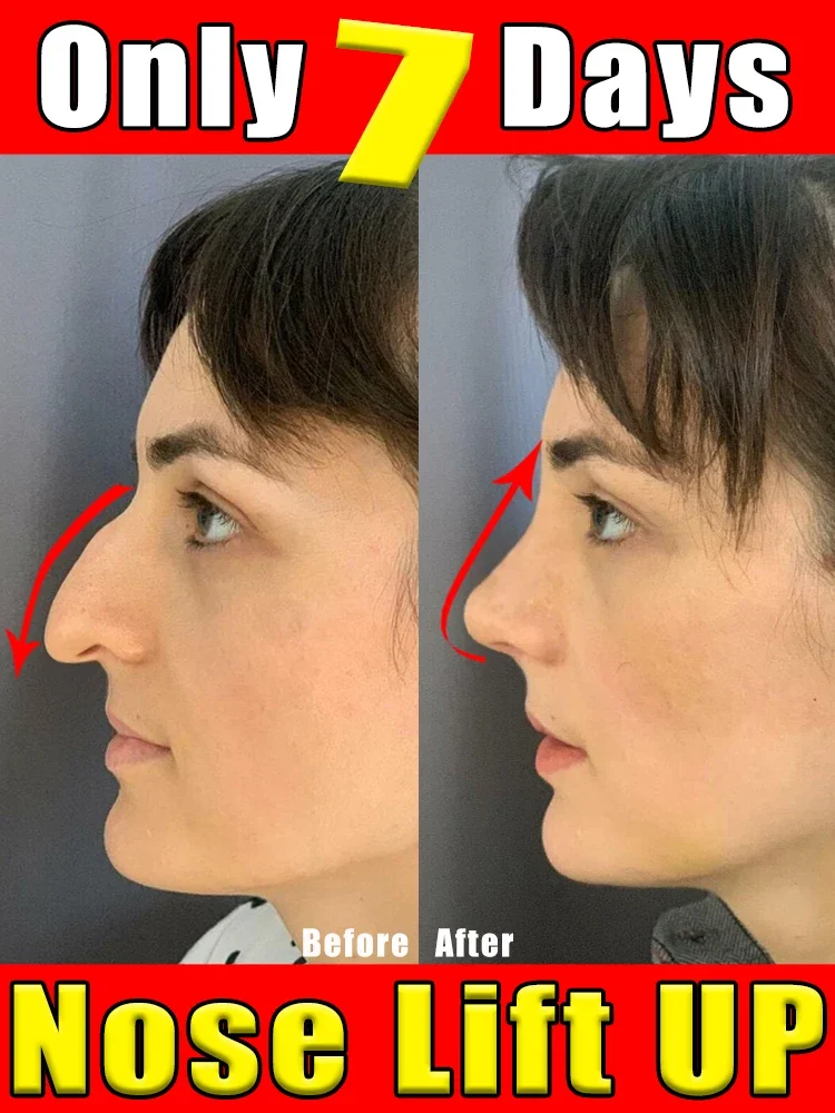 

Nose High Nose Lift Up Essential Oil Nose Lift Up Magic Serum Beautiful Nose Up Oil Reduce Narrow Thin Beautiful Beauty Health