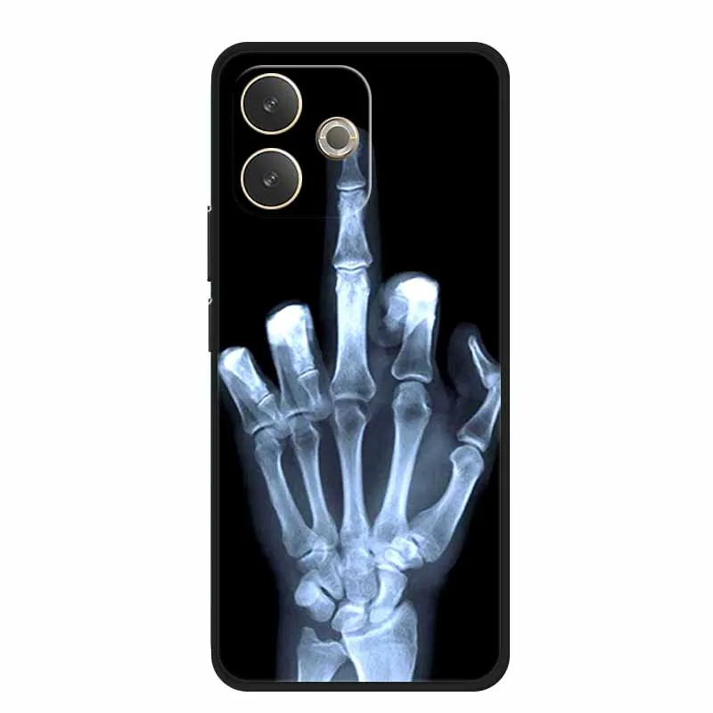 Oppo A5 Pro Soft TPU Silicone Protective Phone Case